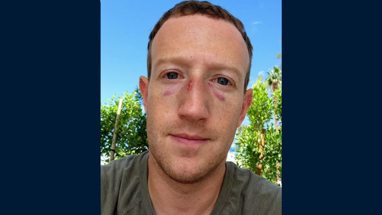 Mark Zuckerberg Shares Selfie With Two Black Eyes Due to Injuries Sustained During Jiu-Jitsu Training, Says 'Sparring Got a Little Out of Hand'