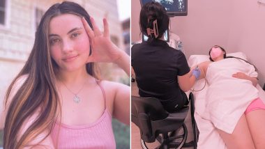 Water Allergy: US Woman Opens up on Her Rare Allergy to Water, Says ‘Skin and Scalp Would be Bleeding After Shower, Drinking Water Causes Burning in Throat’ (See Pics)