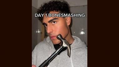 Bone Smashing Trend Goes Viral on TikTok; Know All About Dangerous Social Media Challenge Making People Hit Their Faces With Hammers