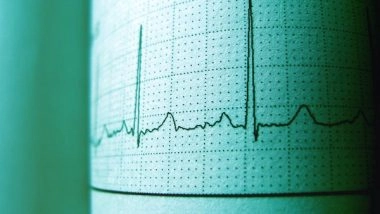 Science News | Study Uses AI to Identify People with Irregular Heartbeats