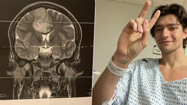 Barton Cowperthwaite Diagnosed With Stage 2 Glioma, Tiny Pretty Things Actor Faces Brain Surgery (View Post)