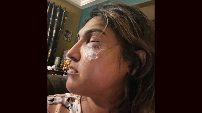 Actress Vanitha Vijayakumar, Former Bigg Boss Tamil Contestant, Shares Shocking Image of Assault, Suspects Link to the Show