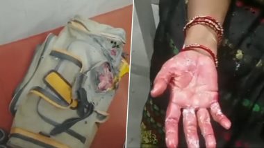 Bihar Train Explosion: Minor Blast in Bhagalpur-Jaynagar Intercity Express Injures Three People, Two Detained (Watch Video)