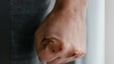 Health News | Researchers Develop New Hydrogels for Wound Management