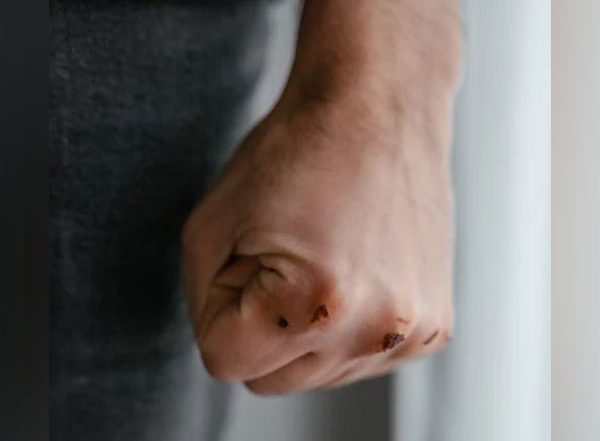 Health News | Researchers Develop New Hydrogels for Wound Management