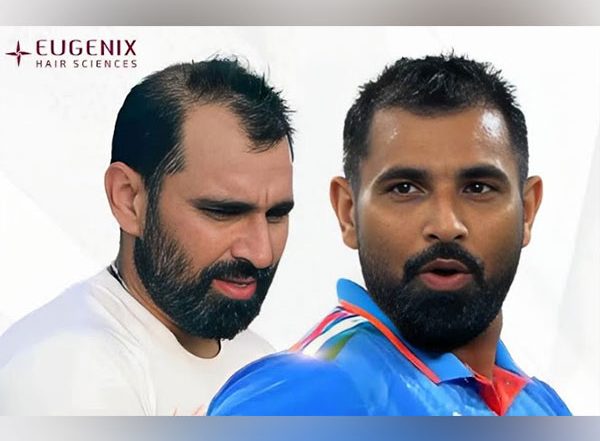 Business News | Mohammed Shami: A Stunning Transformation On and Off the Pitch