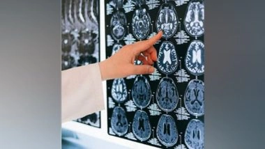 Science News | Researchers Find How Climate Change Could Affect Brain