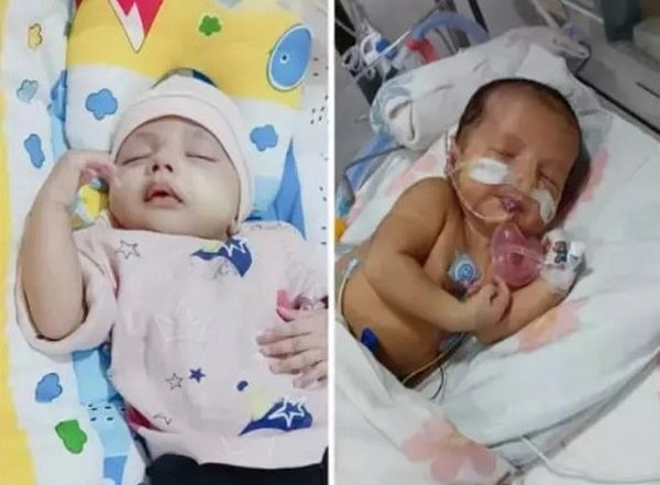 Business News | Fundraising Drive for Baby of Samrah Naqvi Battling Congenital Cyanotic Heart Disease Initiated on ImpactGuru.com