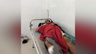 India News | Guwahati: Man Involved in Counterfeit Documents Racket Sustains Injury in Police Firing