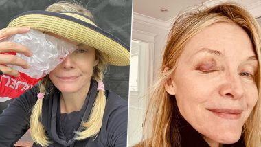 Michelle Pfeiffer Playfully Braves a Black Eye From Pickleball Mishap, Teases Fans With Humorous Snaps (View Pics)