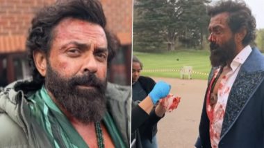 Bobby Deol Gives a Sneak Peek of How He Turned Into 'Abrar' for Sandeep Reddy Vanga's Animal, See BTS Video Here