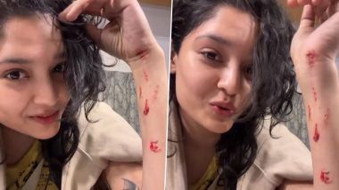 Thalaivar 170: Rajinikanth's Co-star Ritika Singh Injured During Shoot, Shares Video on Instagram - WATCH