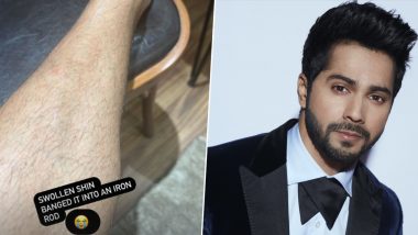 Varun Dhawan Injures Leg During Filming Next Project, Provides Update on Instagram