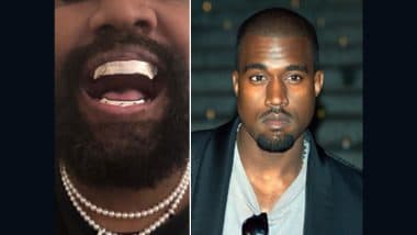 Kanye West Replaces Teeth With Titanium Gnashers, Rapper’s Expensive New Bling Will Remind You of James Bond’s Iconic Villain Jaws (See Pic)