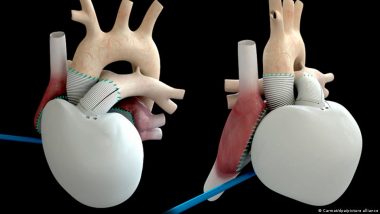 The Dream of an Artificial Heart: How Close Are We?