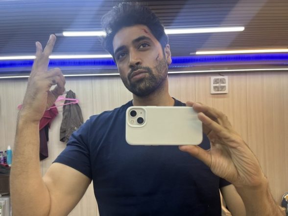 Entertainment News | Adivi Sesh Flaunts His Scars in BTS Picture from Sets of 'G2' - Vimarsana News