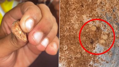 Man Finds Worms Inside Kellogg's Chocos, Company Responds After Video Goes Viral