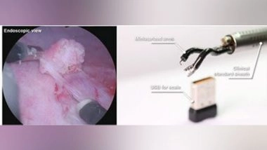 Business News | Agilis Robotics Unveils Groundbreaking Advancements in Endoluminal Surgery