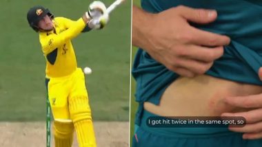 ‘I Got Hit Twice in the Same Spot…’, Jake Fraser-McGurk Shows His Bruises After a Fiery Clash With Alzarri Joseph During AUS vs WI 3rd ODI 2024 (Watch Video)