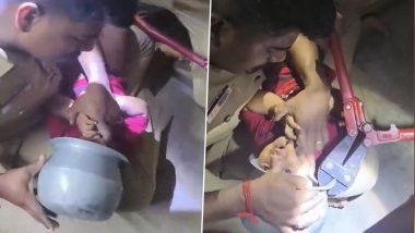 Chennai: Firefighters Use Cutting Pliers To Slice Cooking Vessel Stuck on Toddler’s Head, Video Goes Viral