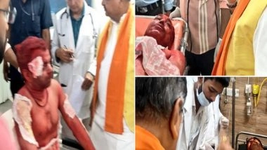 India News | Madhya Pradesh: 8 Injured in Fire at Ujjain's Mahakal Temple Shifted to Indore for Further Treatment