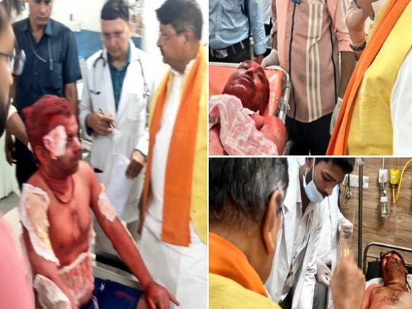 India News | Madhya Pradesh: 8 Injured in Fire at Ujjain's Mahakal Temple Shifted to Indore for Further Treatment - Vimarsana News