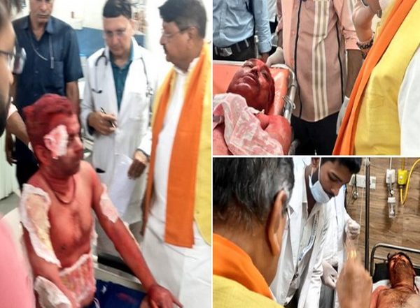 India News | Madhya Pradesh: 8 Injured in Fire at Ujjain's Mahakal Temple Shifted to Indore for Further Treatment