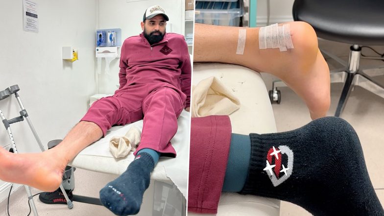 Mohammed Shami Provides Update On Recovery Progress After Achilles Surgery, Shares Picture From Hospital Bed (See Post)