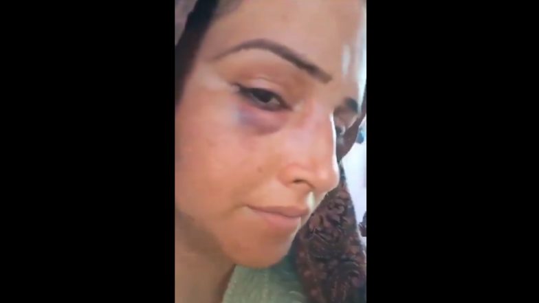 Seema Haider Beaten by Husband Sachin? Alleged Deepfake Videos of Pakistani Woman Showing Injury Marks Go Viral, Police Say Clips Are AI-Generated