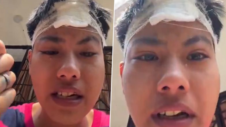 Nepali Tourist Harassed in Assam: Nepal Woman Allegedly Assaulted for &lsquo;Dressing Like a Boy&rsquo; by Group Including Reporter in Mariani, Claims Mockery by Police; Case Registered After Video Goes Viral