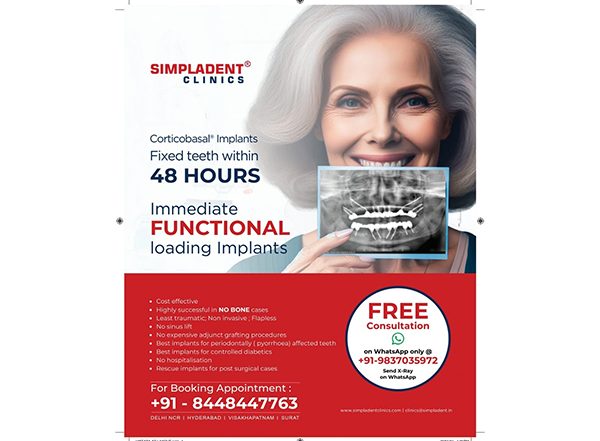 Business News | Simpladent Sparks Nationwide Smiles: Immediate Loading Dental Implants to Soon Reach Every City!