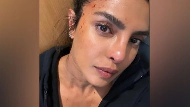 Entertainment News | Priyanka Chopra Shares Photo of Bloodied Forehead from 'Heads of State' Set
