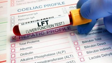 Business News | When Should You Get Liver Function Tests Done? Signs and Symptoms That Warrant Testing