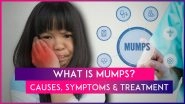 What Is Mumps? Know Causes, Symptoms And Treatment Of The Viral Infection On Rise In Delhi-NCR, Other States