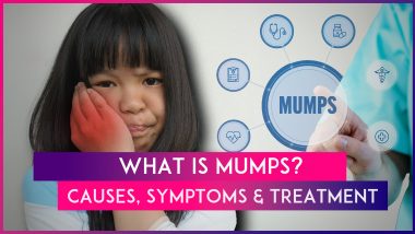 What Is Mumps? Know Causes, Symptoms And Treatment Of The Viral Infection On Rise In Delhi-NCR, Other States