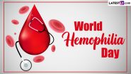 World Hemophilia Day 2024 Date & Theme: Why Is Haemophilia Day Celebrated? Know the History and Significance of the Global Health Event