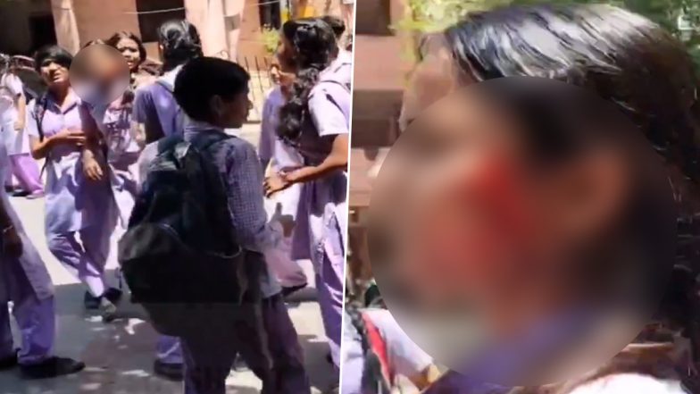 Delhi Shocker: Girl Reportedly Attacked on Face With Blade on Premises of Sarvodaya Vidyalaya School; Disturbing Video Surfaces