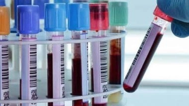 Business News | Aarogya Pathcare Expands Its Health Testing at Home Service to 10 New Cities Across India