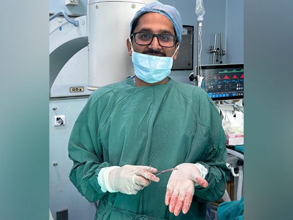 India News | Needle Extracted That Travelled in Veins of a Woman for Three Years - Vimarsana News