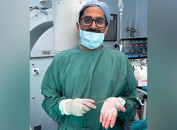 India News | Needle Extracted That Travelled in Veins of a Woman for Three Years