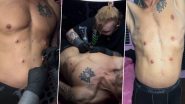 Man With 6 Nipples! 4 Extra Nipples Artificially Attached to Harry Hoofcloppen's Torso in Extreme Body Modification Case (Watch Shocking Videos)