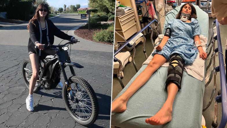 Nina Dobrev Hospitalised After Meeting With Bike Accident; Actress Shares Health Update and Says ‘It’s Going To Be a Long Road of Recovery’ (See Pics)