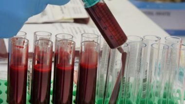 What Happened in UK’s Infected Blood Scandal From 1970s to 1990s? All About Deadly Treatment Disaster That Claimed at Least 3,000 Lives