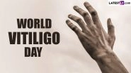 World Vitiligo Day 2024 Date and Theme: Know History and Significance of the Day Dedicated to Raising Awareness About Vitiligo
