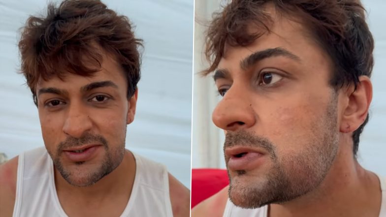 Khatron Ke Khiladi 14: Shalin Bhanot Bitten by 200 Scorpions? Actor Shares Video of His Facial Injury on Rohit Shetty’s Reality Show – WATCH