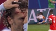 Antoine Griezmann&nbsp;Suffers Head Injury After Crashing Into Advertising Board During Austria vs France UEFA Euro 2024 Match (See Pics)