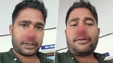 Mumbai: Locksmith's Nose Fractured After Sub-Inspector Allegedly Assaults Him Over Pending Payment of Rs 20 at Manikpur Police Station, Suspended (Watch Video)