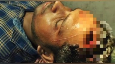 India News | Lok Sabha Polls: ANI Stringer Bunty Mukherjee Severely Injured in TMC-BJP Clashes in West Bengal