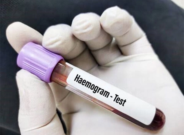 Business News | Why is a Hemogram Test Prescribed?