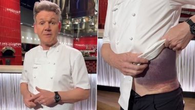 Gordon Ramsay Accident: On Father’s Day, Celebrity Chef Gives Message to All Dads to ‘Wear a Helmet’ Following Bike Injury, Shows His Bruised Torso via Video Post